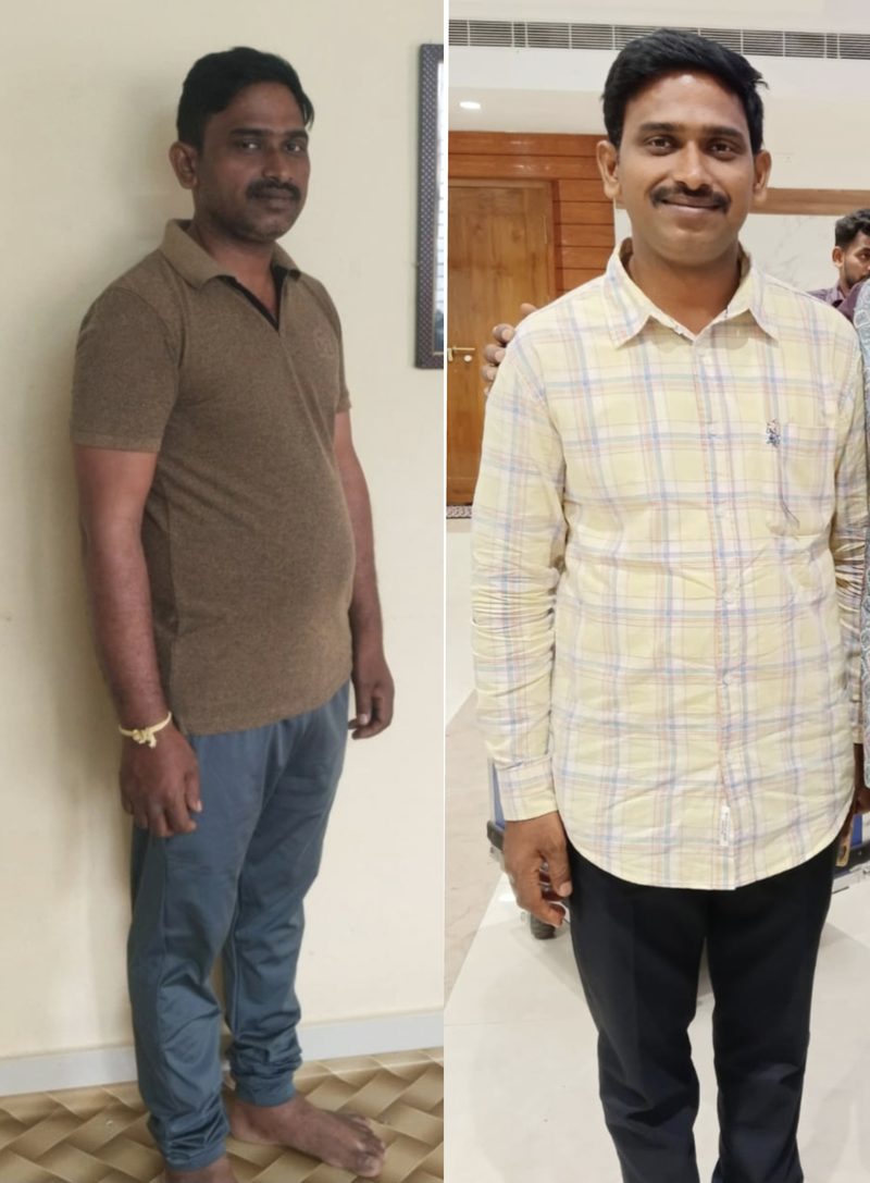 J Ramkumar before and after